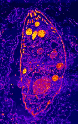 Toxoplasmosis diagnose kit developed in Holguin Cuba